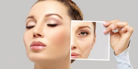 Woman with Dermal Fillers | Carbon Blush