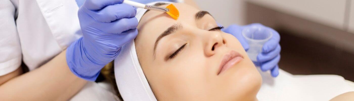 Skin Peels