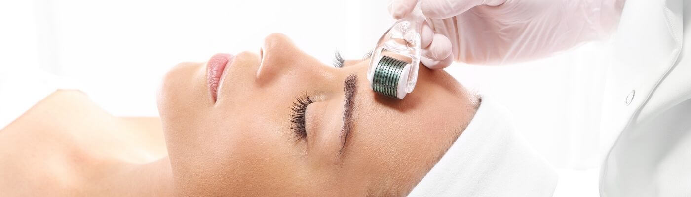 Microneedling