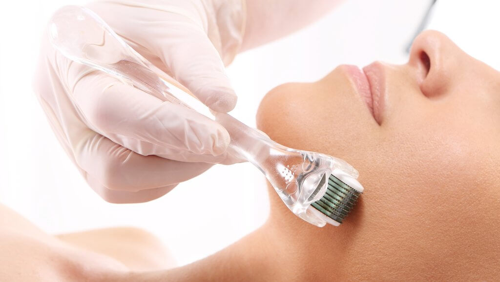 Microneedling Treatment | Carbon Blush