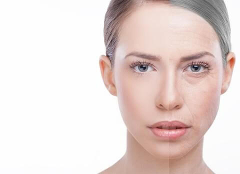 Woman Before and After Skin Peel | Carbon Blush