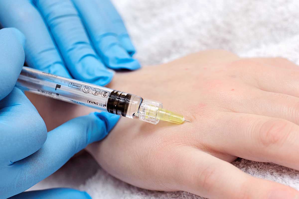 Inserting Profhilo into Hand
